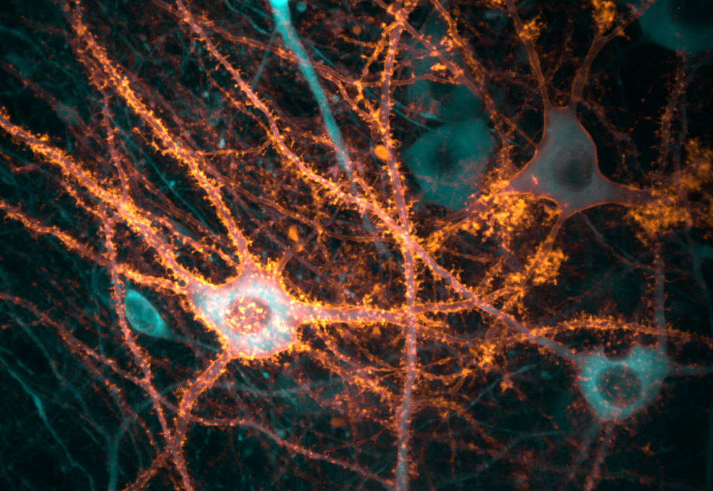 Neurons in the hippocampus, the brain’s memory centre. Amber marks light-sensitive molecules used to control the cells, while turquoise reveals their activity. 